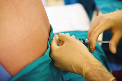 epidurale come viene fatta